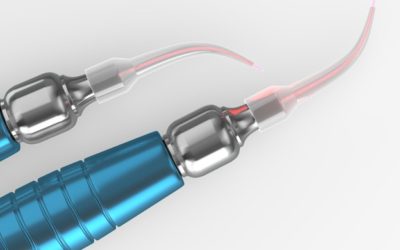 Laser Endodontics: How Lasers Modernize Root Canal Therapy