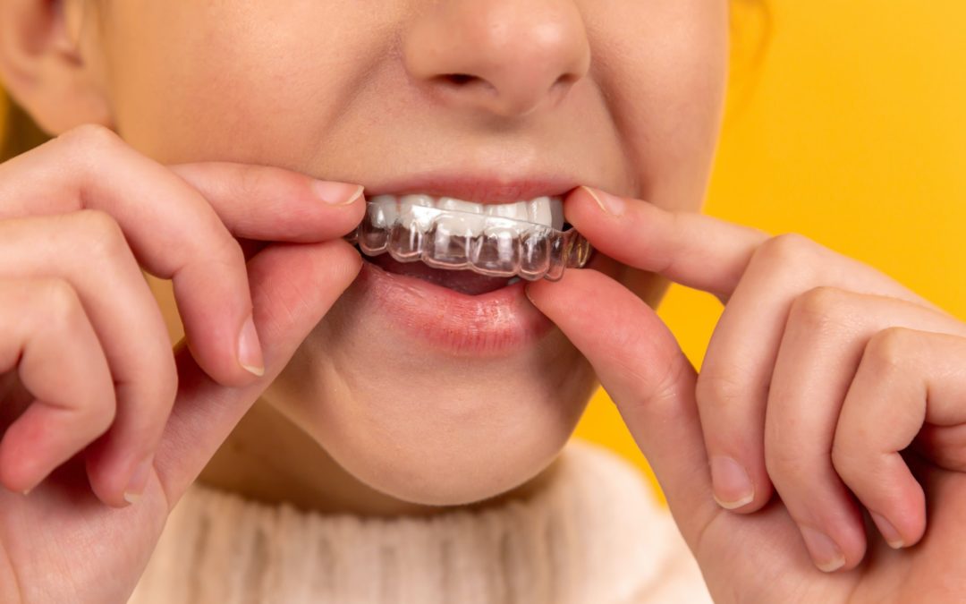 Close-up of teen with clear braces