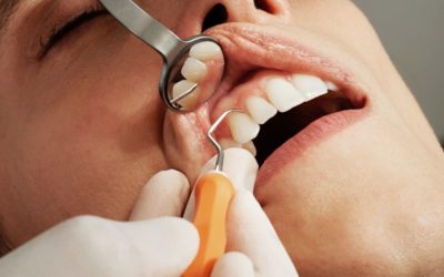 DIAGNOdent, Intraoral Cameras, and Isolite: Dental Technology to Enhance Your Care