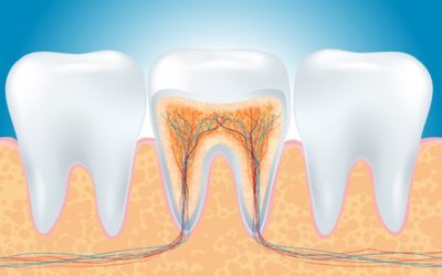 Root Canals: Saving Your Teeth and Smile